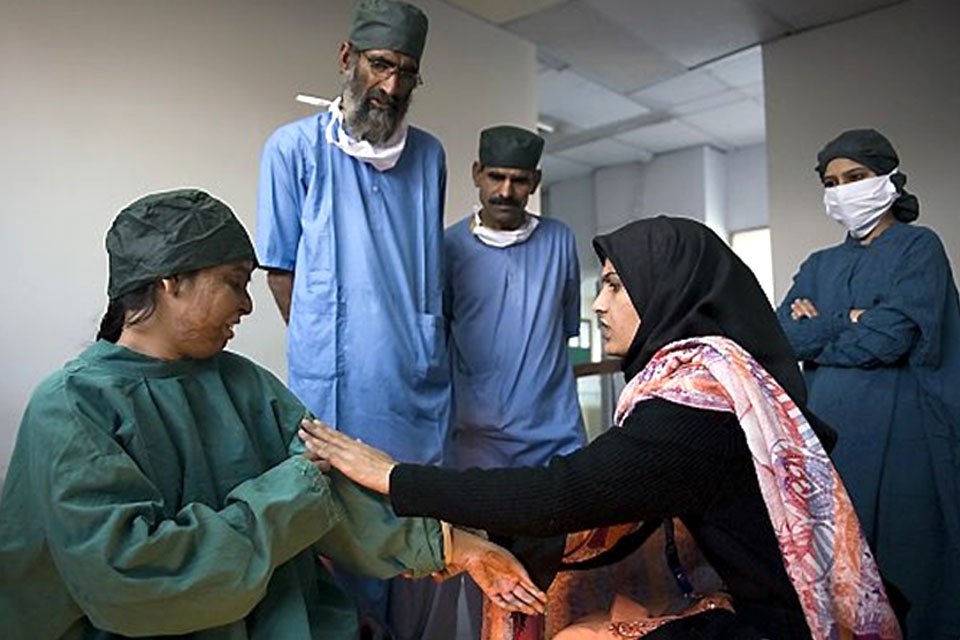 burn victims support